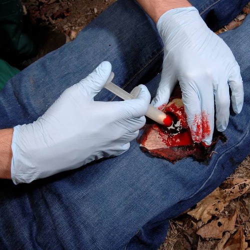 Аппликатор гемостатический с гранулами Rhino Rescue в Зеленограде хитозановый